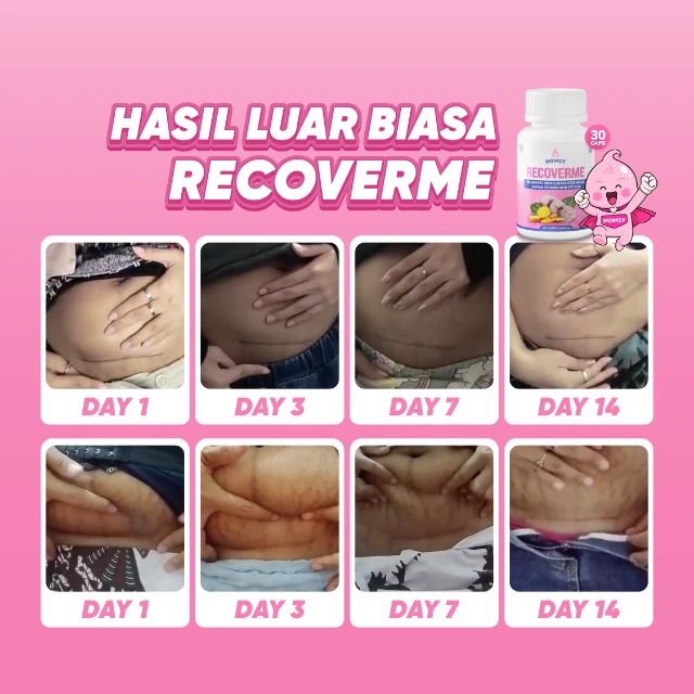 Kandungan Aktif RecoverMe